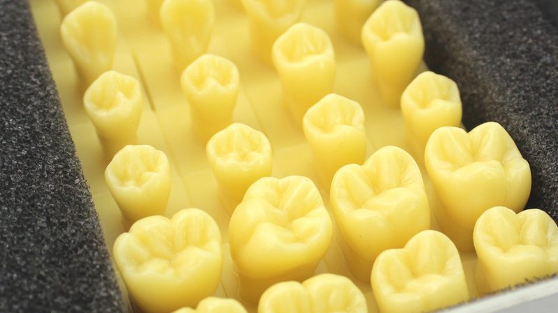 成都洗牙团购，喷砂洁牙效果与价格分析